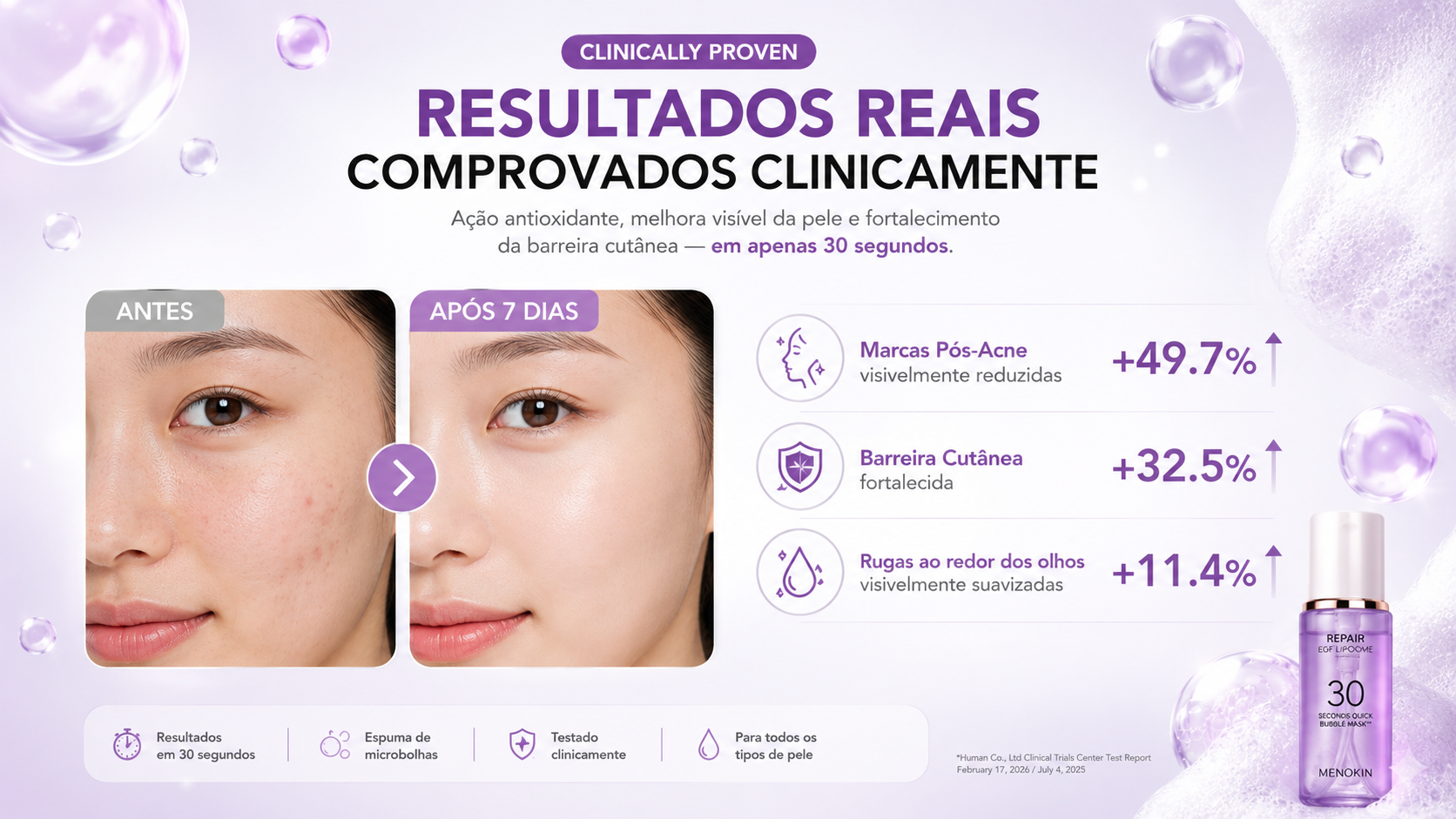 Resultados clínicos MENOKIN Bubble Mask